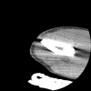 SPORK, NICO - 22.03.1976 - 02.08.2022 - CT obere Extremität - 17:51:17